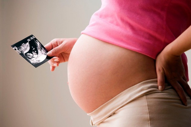 Беременная женщина держит в руке снимок УЗИ