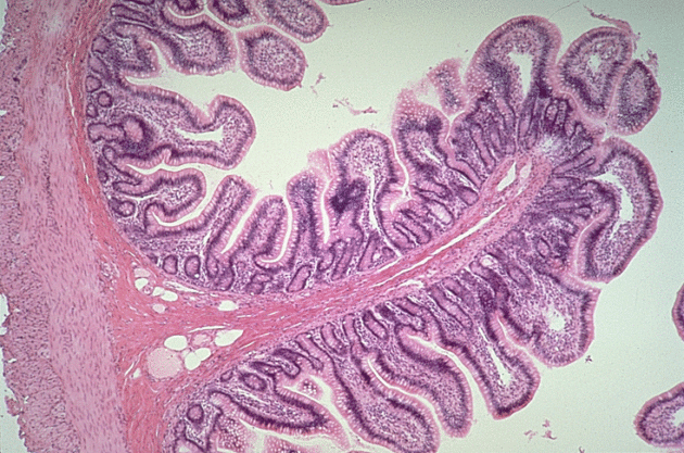 Париетальные клетки желудка