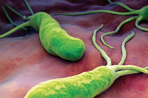 Бактерия Helicobacter pylori оказывает прямое воздействие на метаболизм клеток желудка