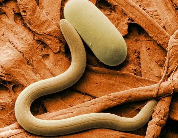 нематоды - один из видов паразитов человека